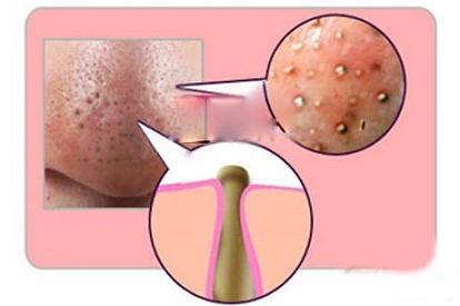 请保持安全距离以防近看美女早已不见