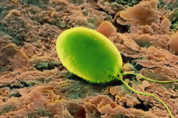 衣藻是单细胞生物吗 衣藻的特点