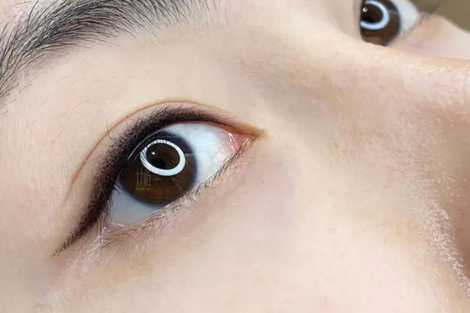 美瞳线多久恢复自然 美瞳线的好处