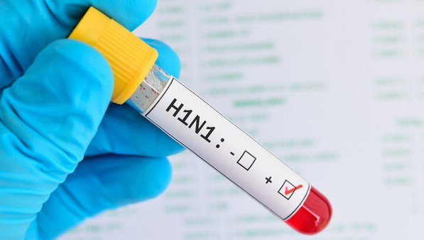俄罗斯全境地区均现甲型H1N1流感