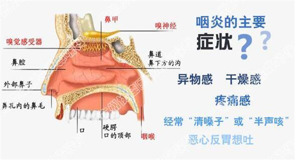 喉咙天天痒